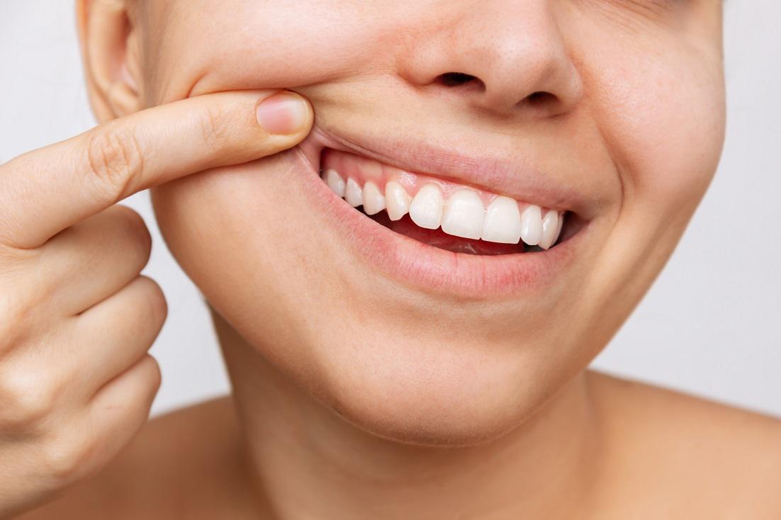Gum Care 101: Your Ultimate Guide to Healthy Gums